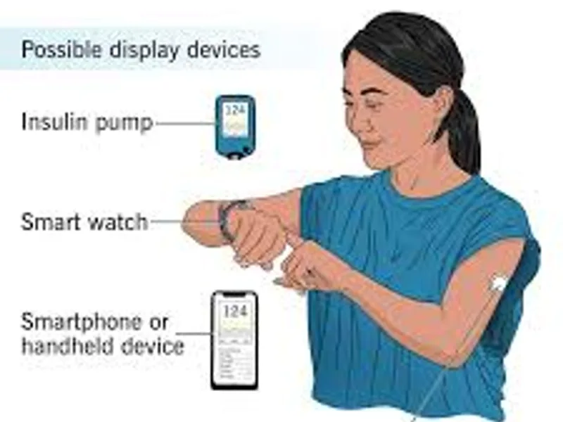Glucose Drain Fluid Test: What You Need to Know