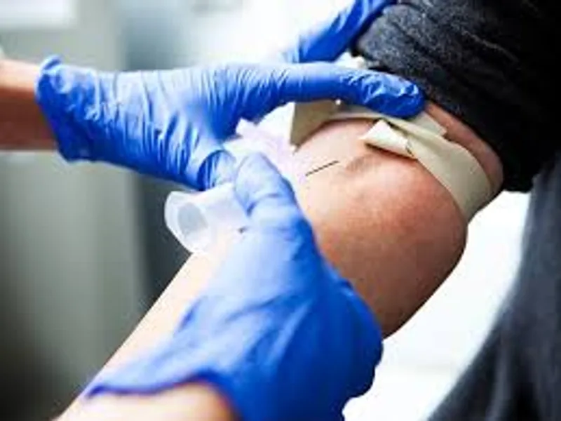 LDH Drain Fluid Test: What It Reveals About Your Health