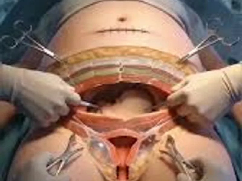 Gynecology Surgery Costs in Kolkata: A Detailed Guide