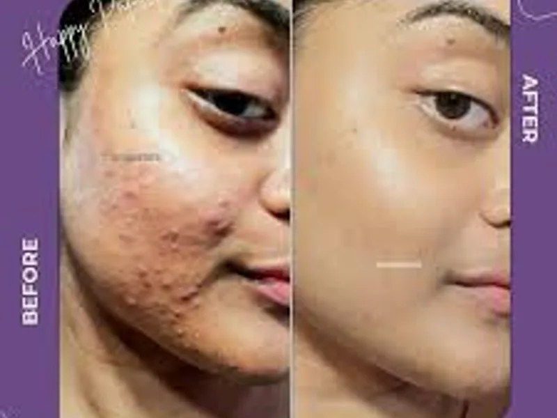 best skin care clinic in Kolkata