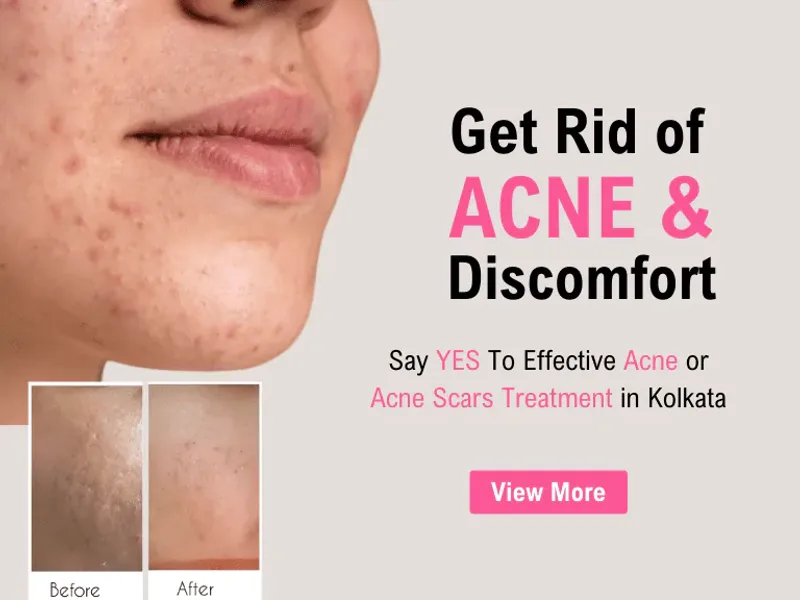 Top Dermatologist in Kolkata
