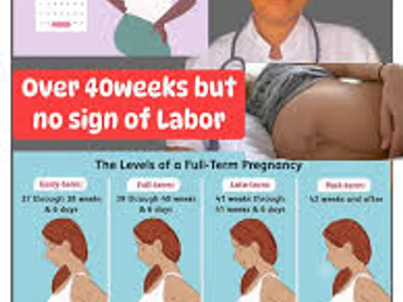 Labour not starting at 40 weeks: what to do