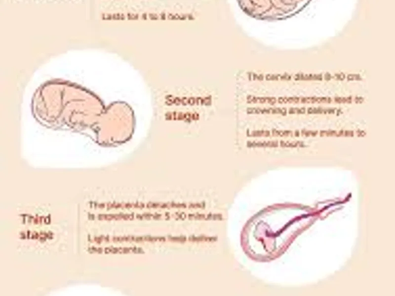 Overdue Pregnancy and Induction of Labour Guide