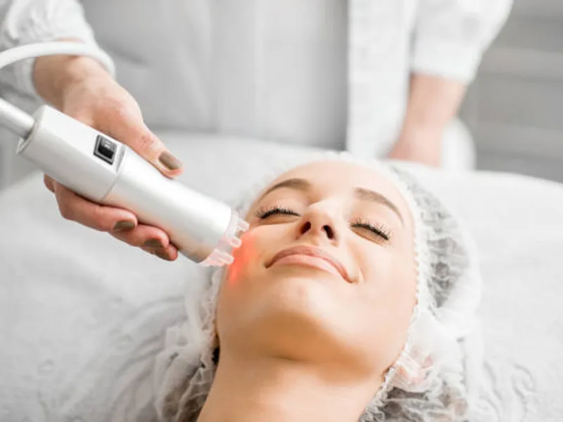 Dark Spot Removal in Kolkata
