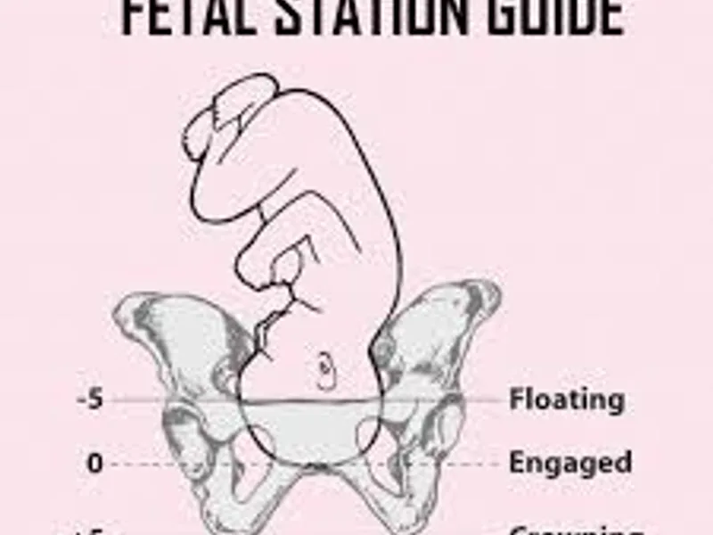 Baby Not Engaged at 9 Months Pregnancy: What to Know