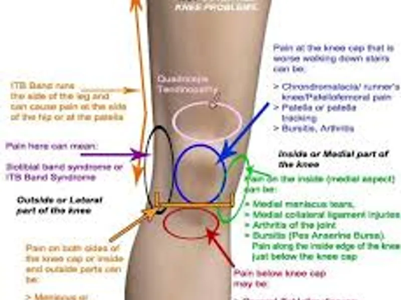Knee Pain Physiotherapy in Bokaro: Expert Care for Relief