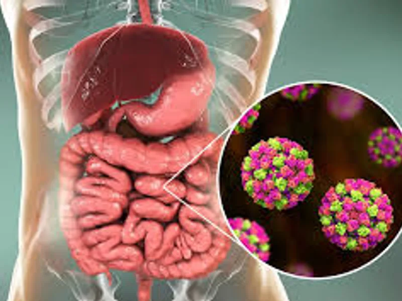 Best Digestive Problem Doctor in Kolkata | Expert Care