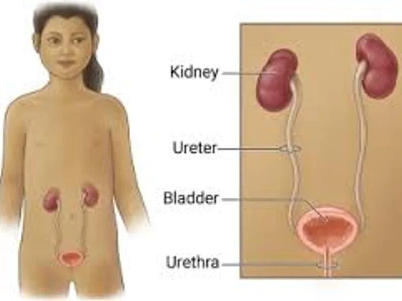 Child Cystoscopy Surgery in Deoghar
