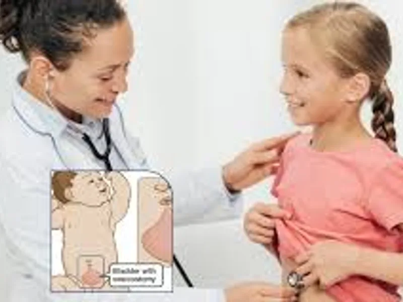 Vesicostomy Surgery in Deoghar | Cost, Best Surgeons & Pediatric Urology Treatment Guide 2025