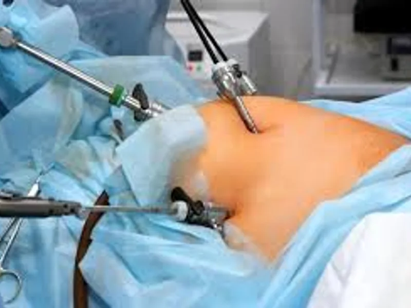 Inguinal Herniotomy Surgery in Deoghar | Cost, Best Surgeons & Treatment Guide 2025