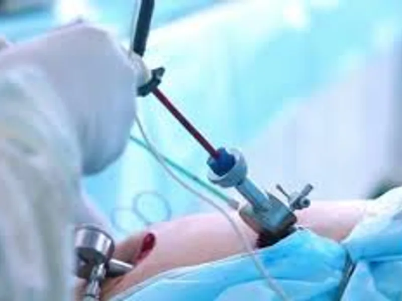 Child Laparoscopic Abdominal Cyst Operation in Deoghar