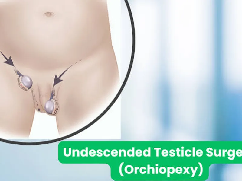 Female Undescended Testis Unilateral Surgery in Deoghar