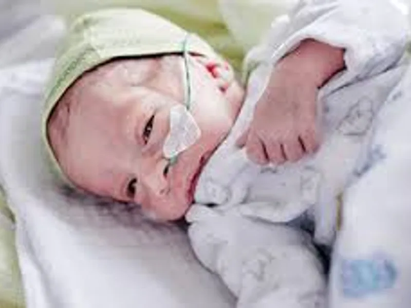 Child children hospital in Deoghar 2