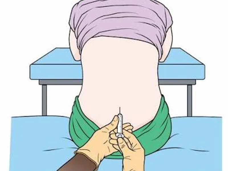 Female Lumbar Puncture in Deoghar