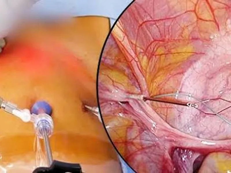 Female Pediatric Surgery in Deoghar