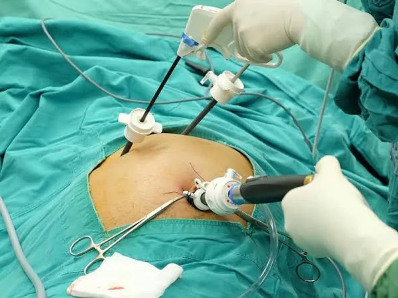 Female Gallstone Surgery in Deoghar