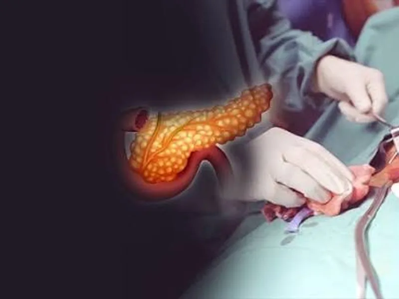 Female Pancreatic Ring Operation Surgery in Ranchi