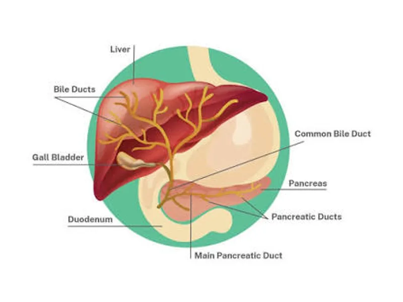 Female Atresia of Extra Hepatic Biliary Duct Surgery in Ranchi