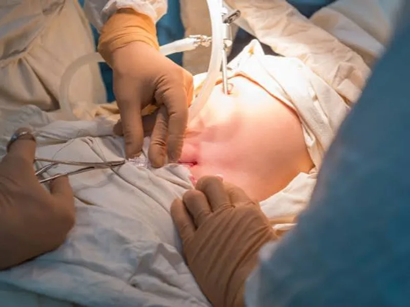 Female Pediatric Surgery in Ranchi