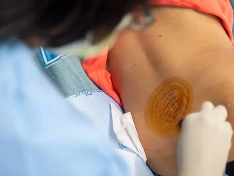 Female Lumbar Puncture in Ranchi