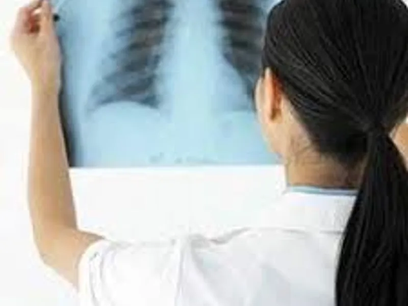 Female X-ray Services in Ranchi