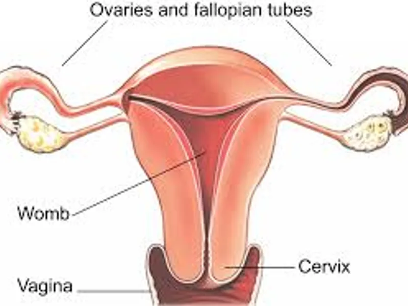 Female Laparoscopic Oophorectomy Surgery in Dhanbad