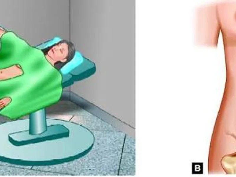 Female Laparoscopic Appendectomy Surgery in Dhanbad