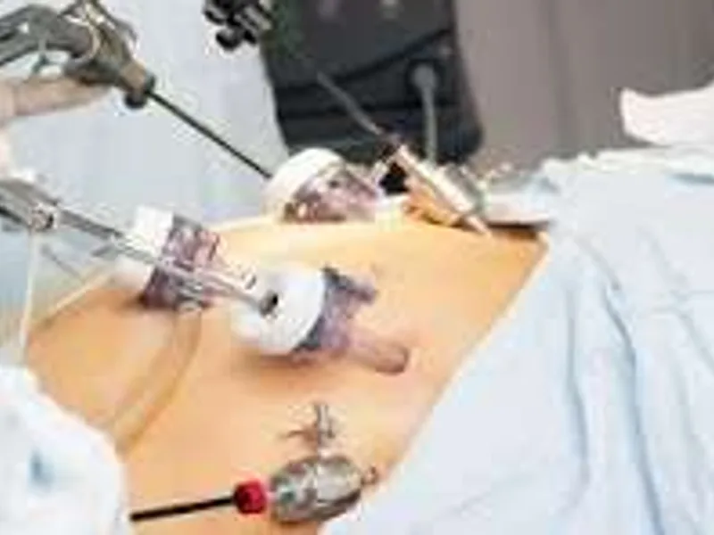 Female Laparoscopic Surgery in Dhanbad