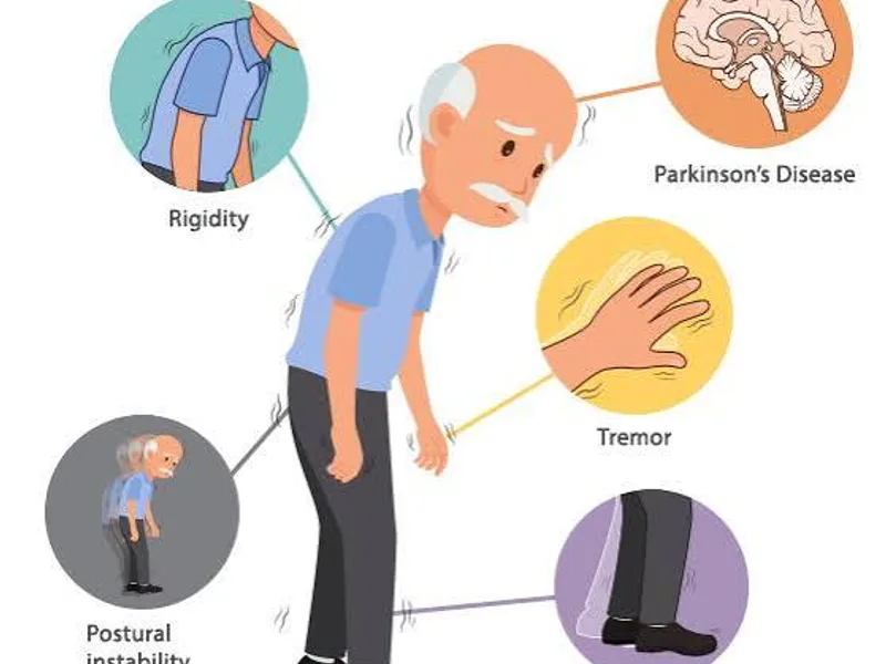 Parkinson's Disease: Symptoms, Causes & Treatment