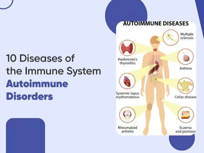 Autoimmune Disease: Causes, Types & Treatment Options