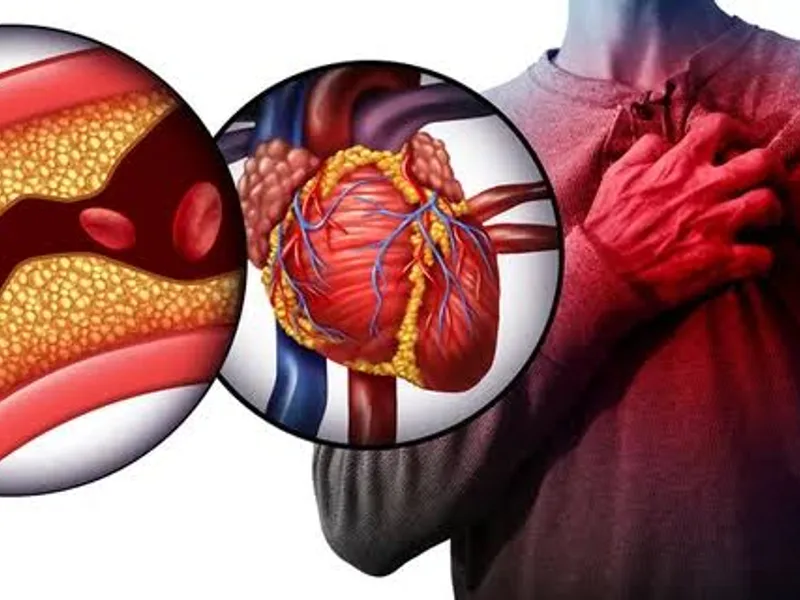 Cardiology Diseases: Types, Symptoms & Treatment Guide