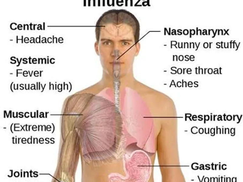 Influenza Disease: Symptoms, Causes & Treatment Guide
