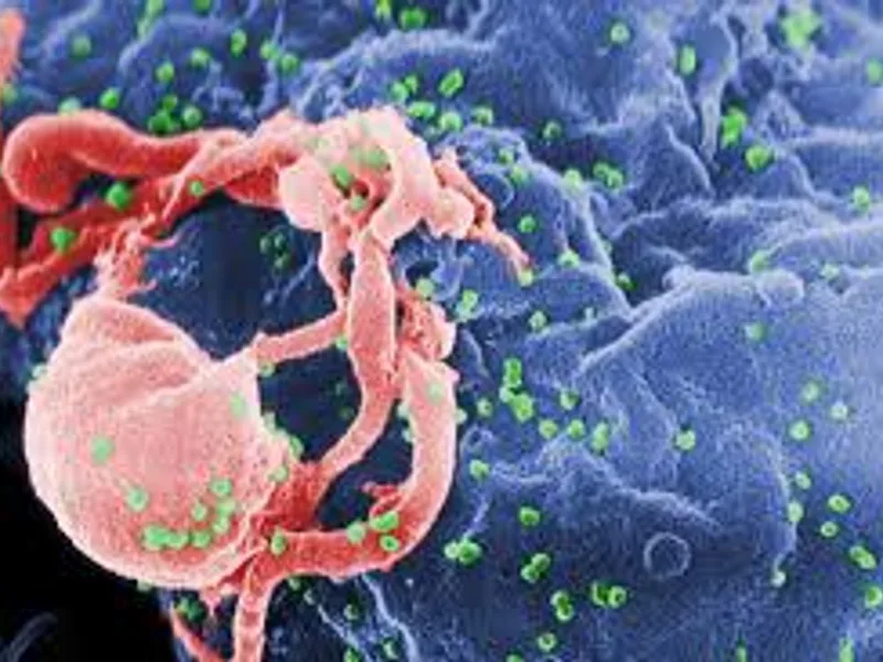 HIV Disease: Symptoms, Causes & Treatment Guide