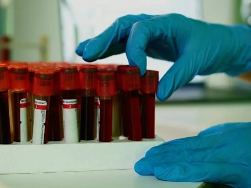 Blood Test Predicts Dementia Years Before Symptoms