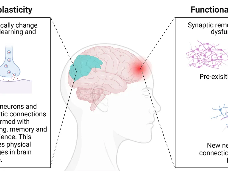 Neuroplasticity Retreat Studies: What the Research Shows