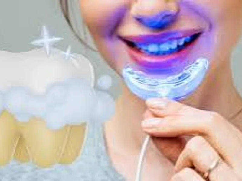 Teeth Whitening Near Me: What to Actually Check First