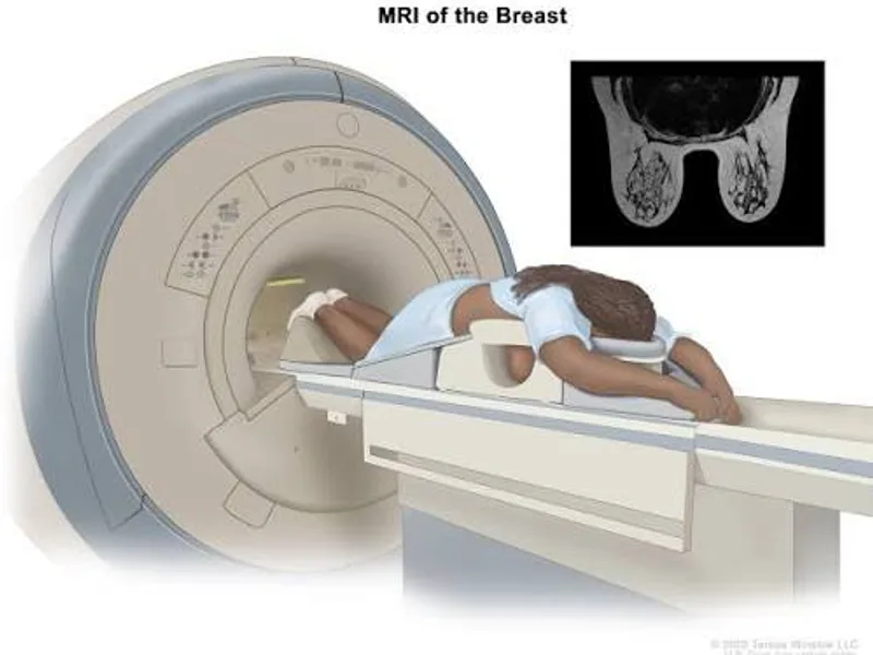 mammogram screening