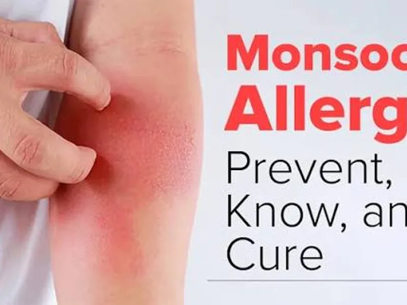 Skin Allergies During Monsoon: What to Know