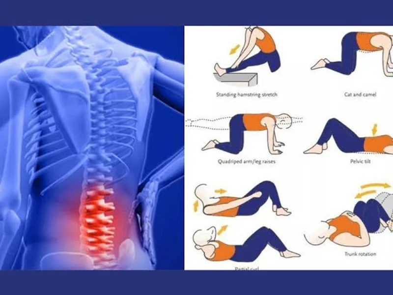 Best Exercises for Lower Back Pain