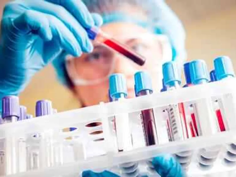 Blood Test at Home in Kolkata