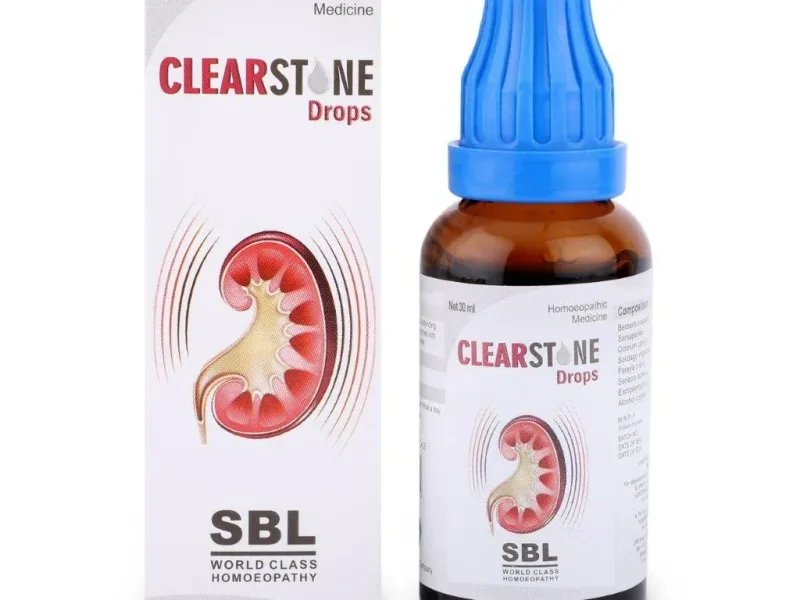 Homeopathy for Kidney Stone Treatment in Asansol