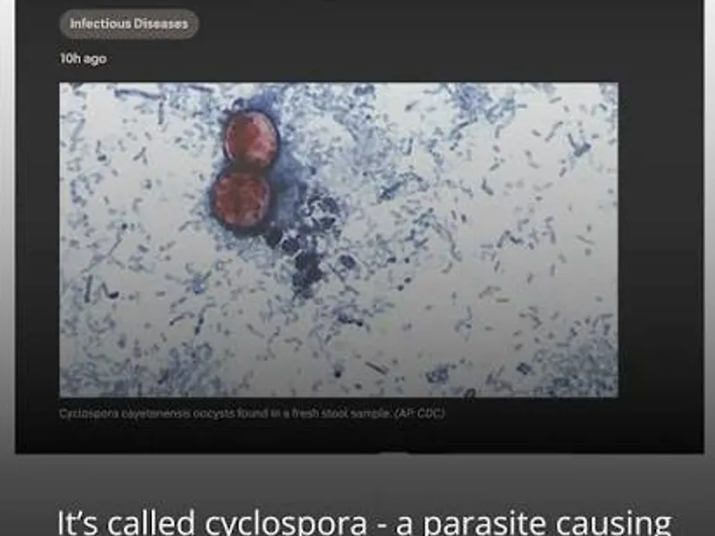 Cyclospora Outbreak 2026: What's Behind the Illness Spike