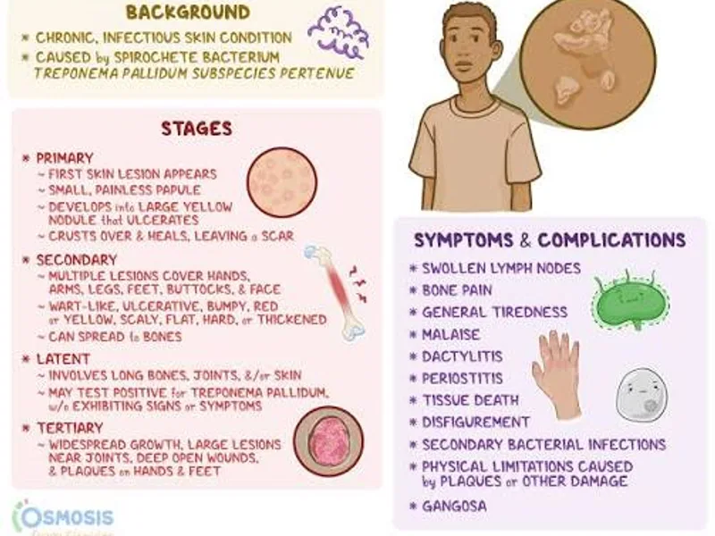 Ancient Yaws Transmission Study Changes Disease History