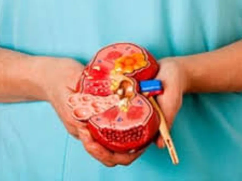 Lupus Glomerular Hematuria: What Blood in Urine Means