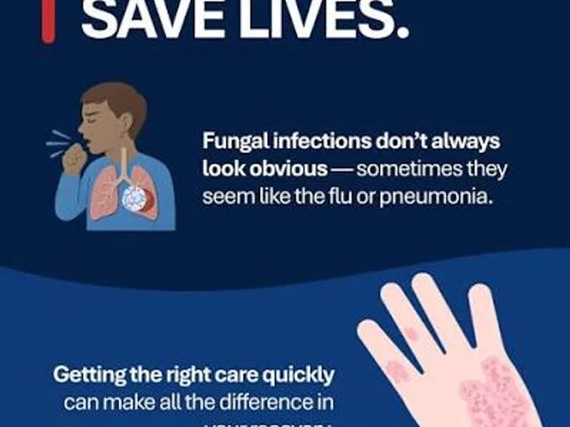 CDC Fungal Infection Warning: What to Know