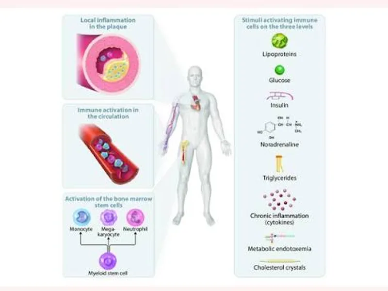 ASCVD inflammation rethink