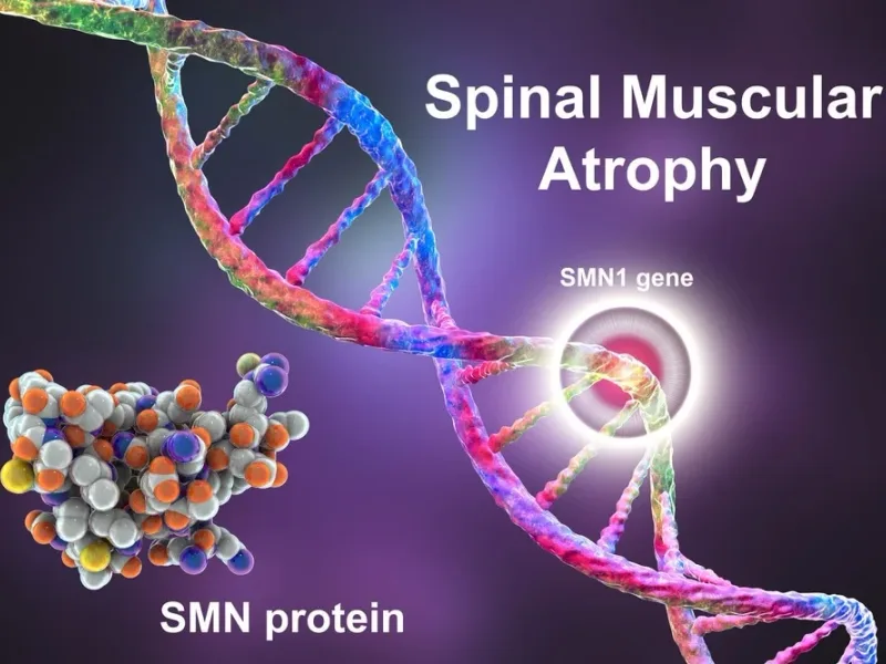 Spinal Muscular Atrophy Gene Therapy: 2026 Updat