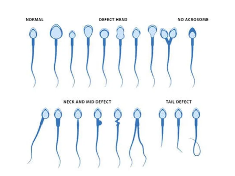 Semen analysis β what it measures