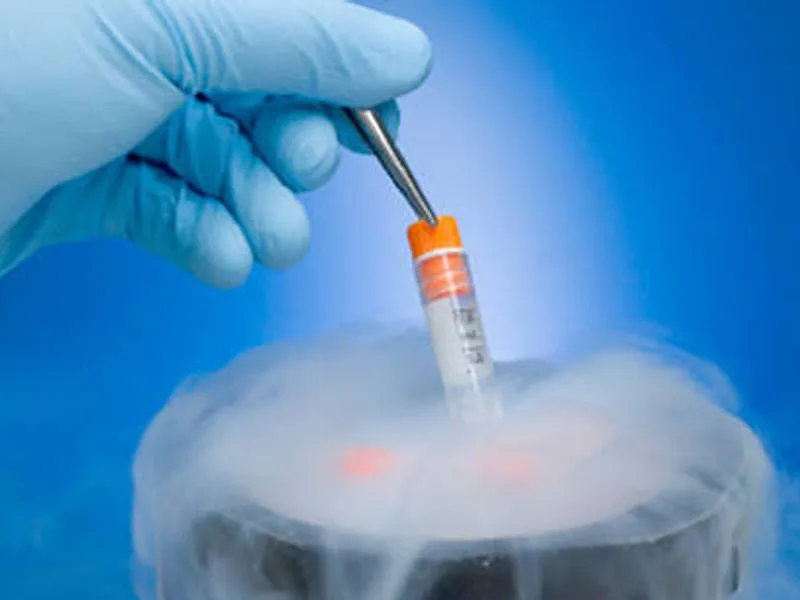 Sperm freezing process