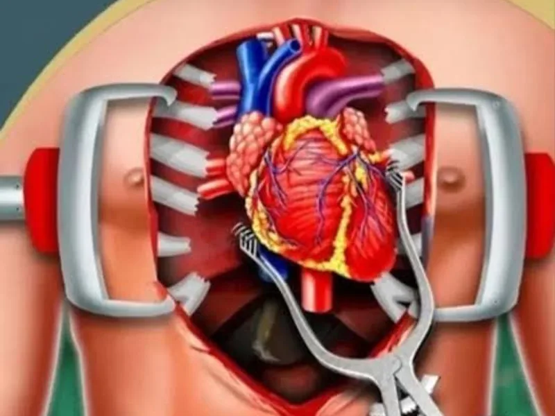 Heart Bypass Technique Advance: What's Changed in 2026